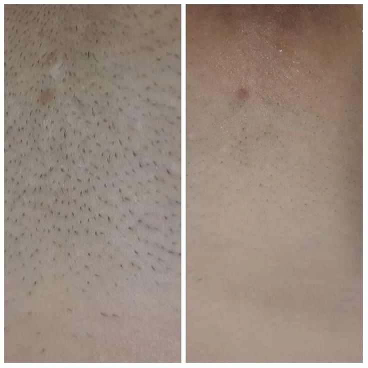 Velora borotvagép - Velora™