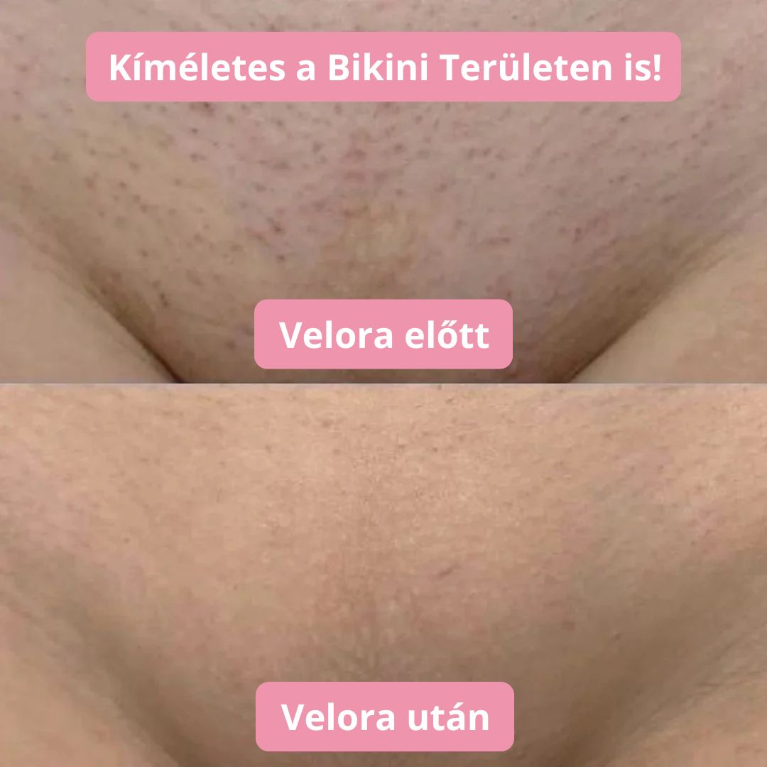 Velora borotvagép - Velora
