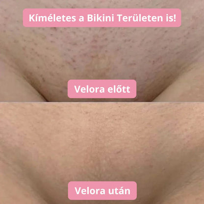 Velora borotvagép - Velora